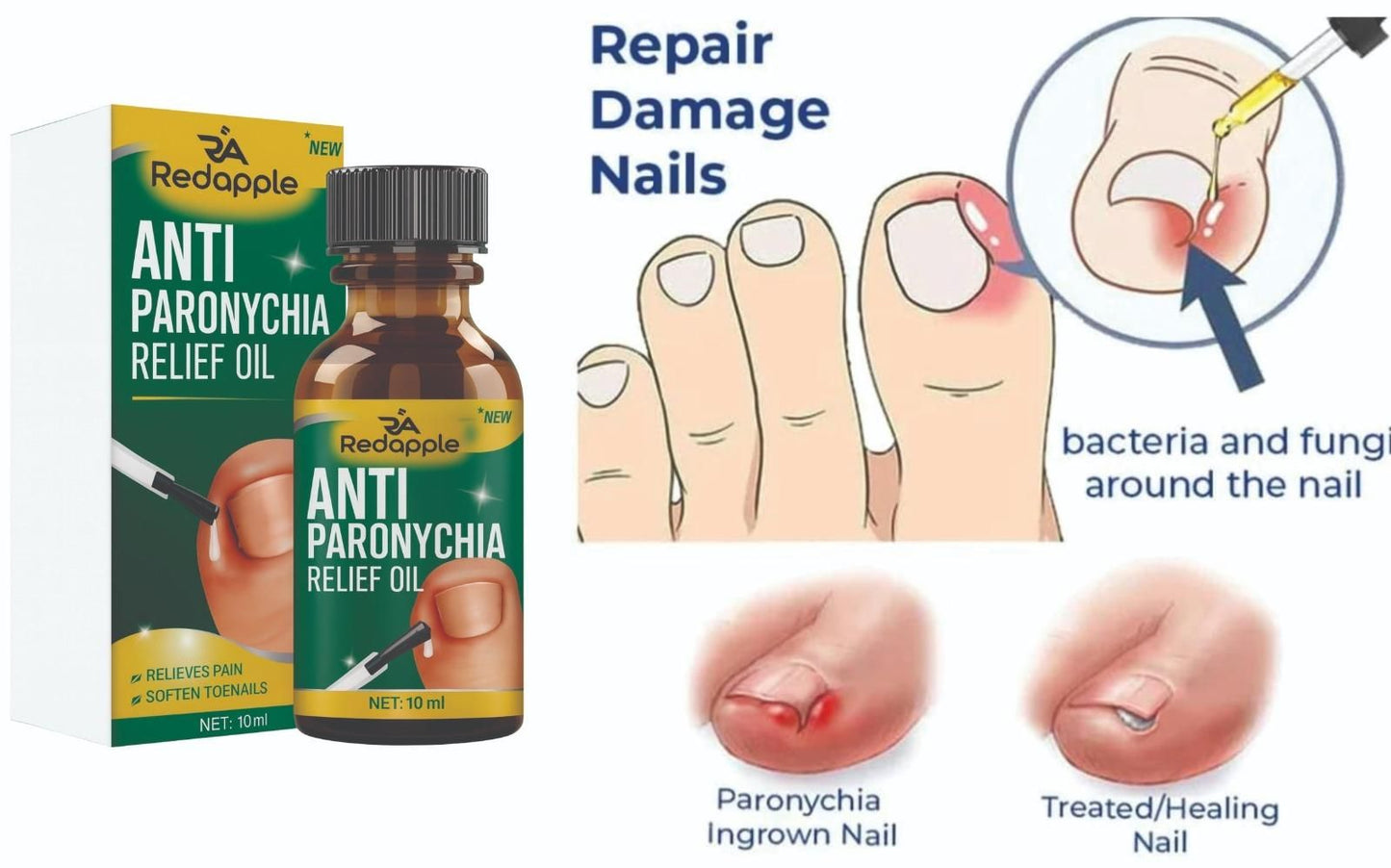 Advanced Anti-Paronychia Healing & Relief Oil